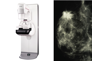 マンモグラフィ